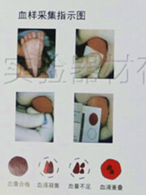 新生儿采血卡 新生儿采血卡